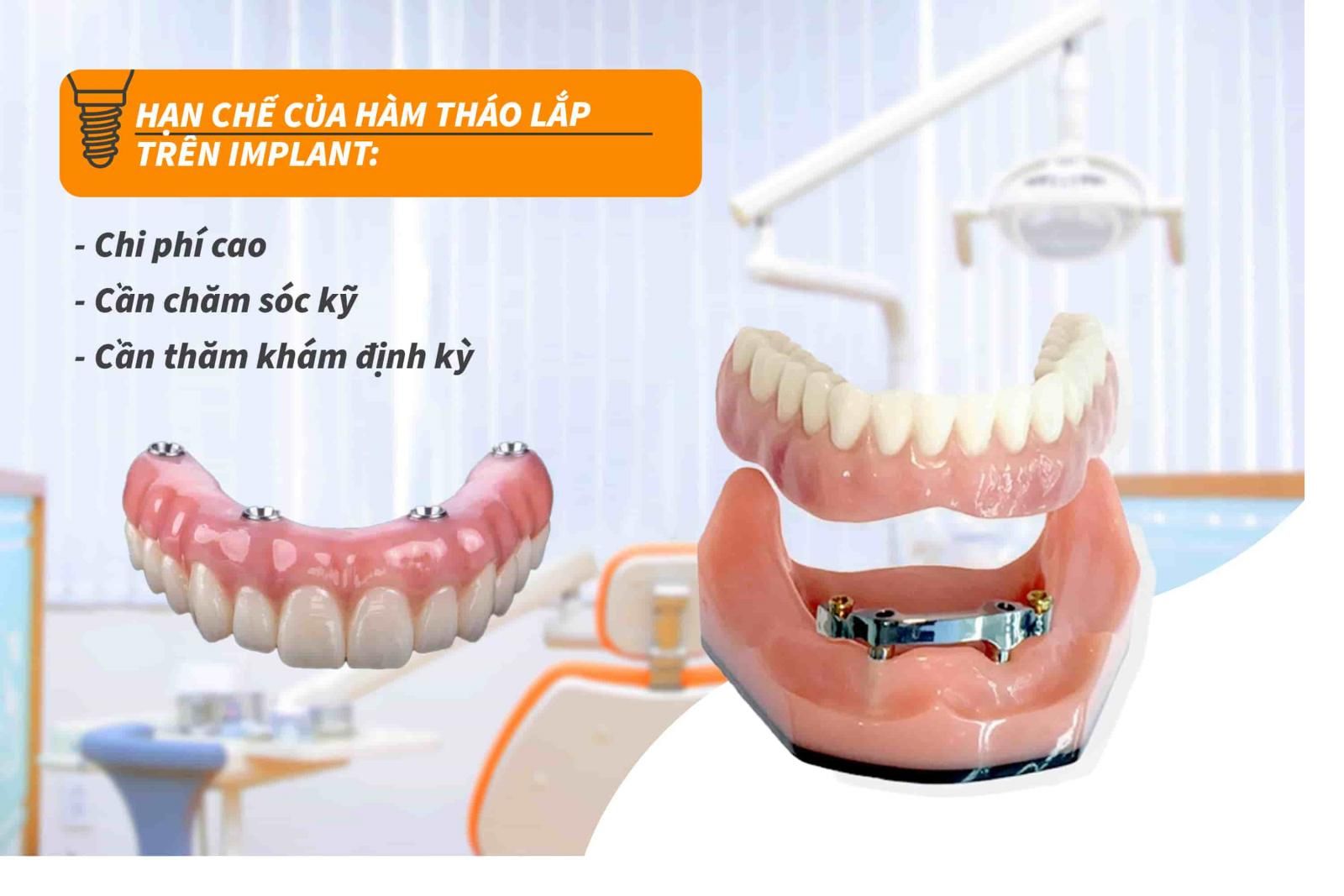 Hạn chế của hàm tháo lắp trên Implant