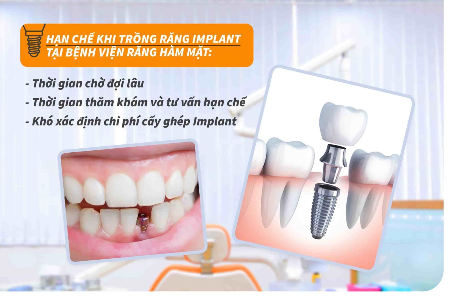 Hạn chế khi trồng răng Implant tại bệnh viện răng hàm mặt