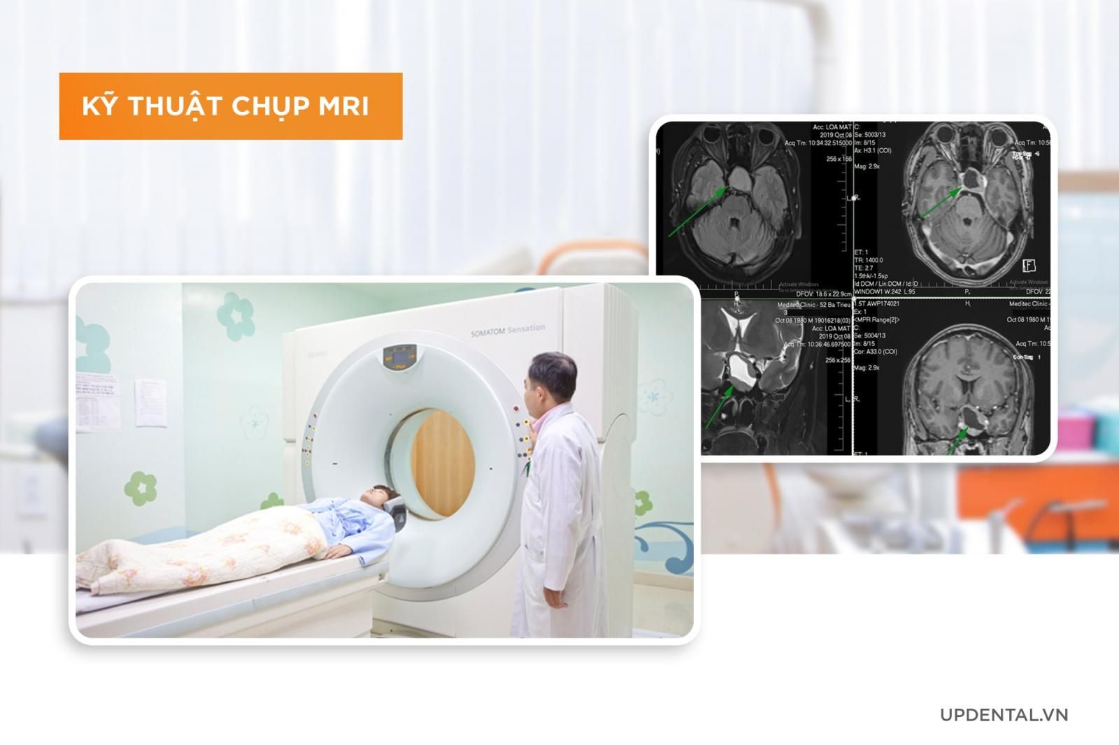 kỹ thuật chụp MRI khi niềng răng