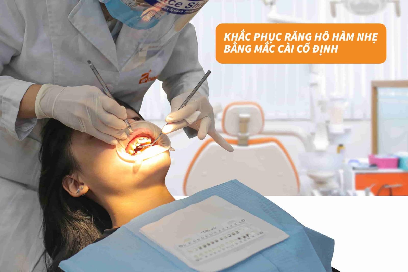 Khắc phục hô hàm nhẹ bằng mắc cài cố định