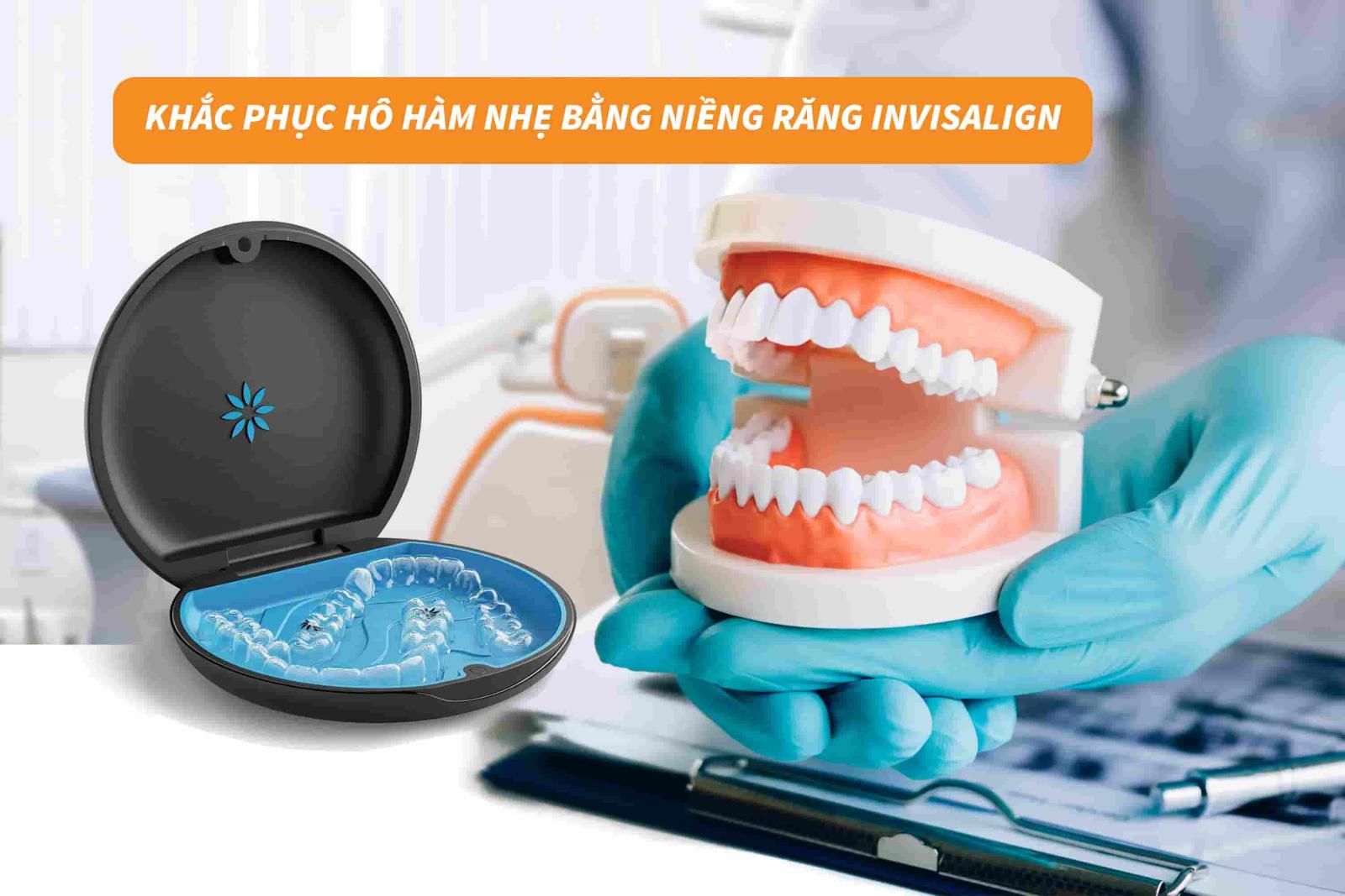 Khắc phục hô hàm nhẹ bằng hàm tháo lắp