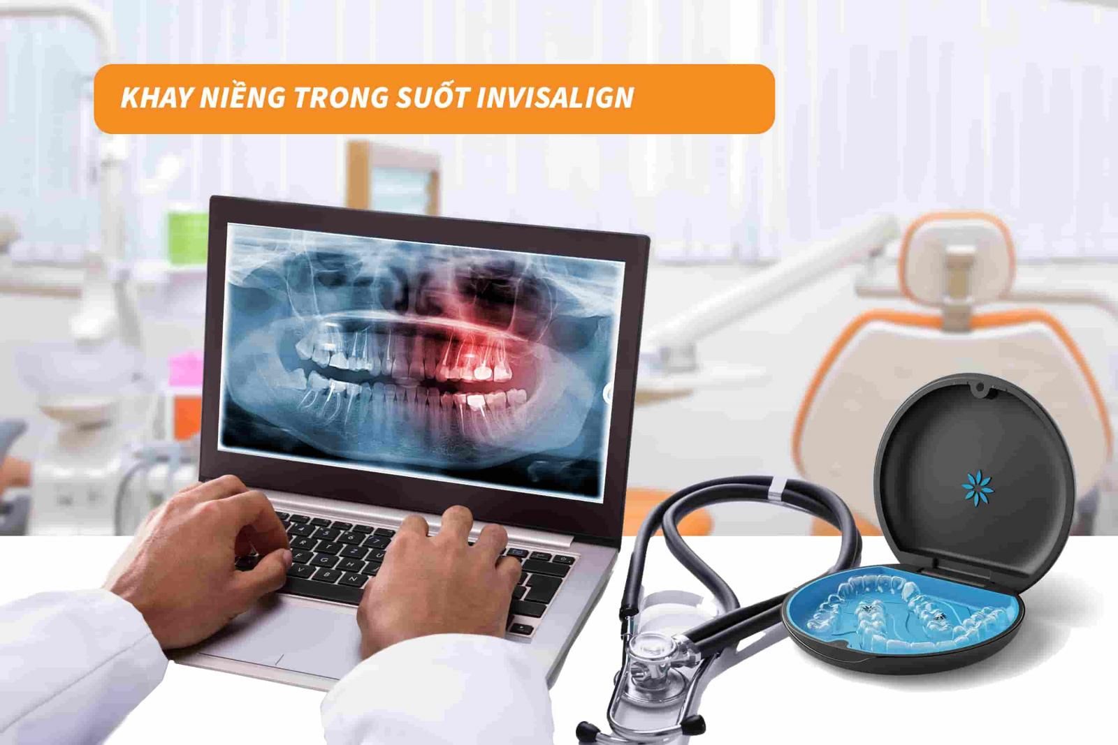 Khay niềng trong suốt Invisalign