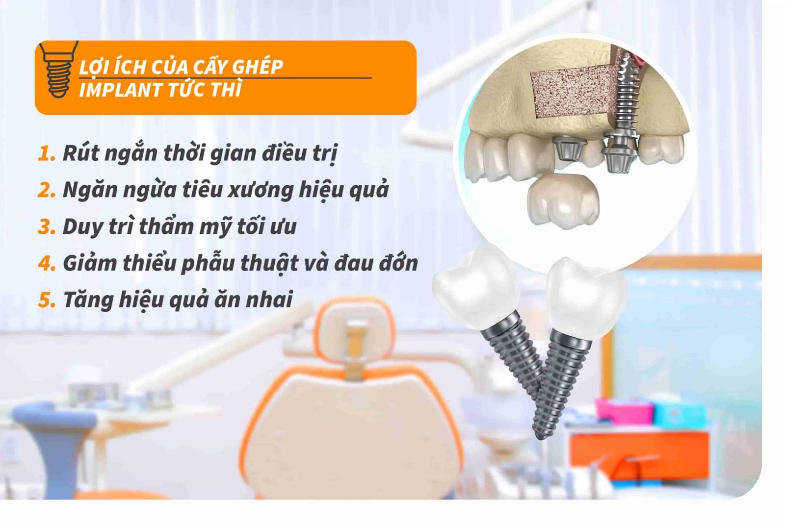 Lợi ích của cấy ghép Implant tức thì