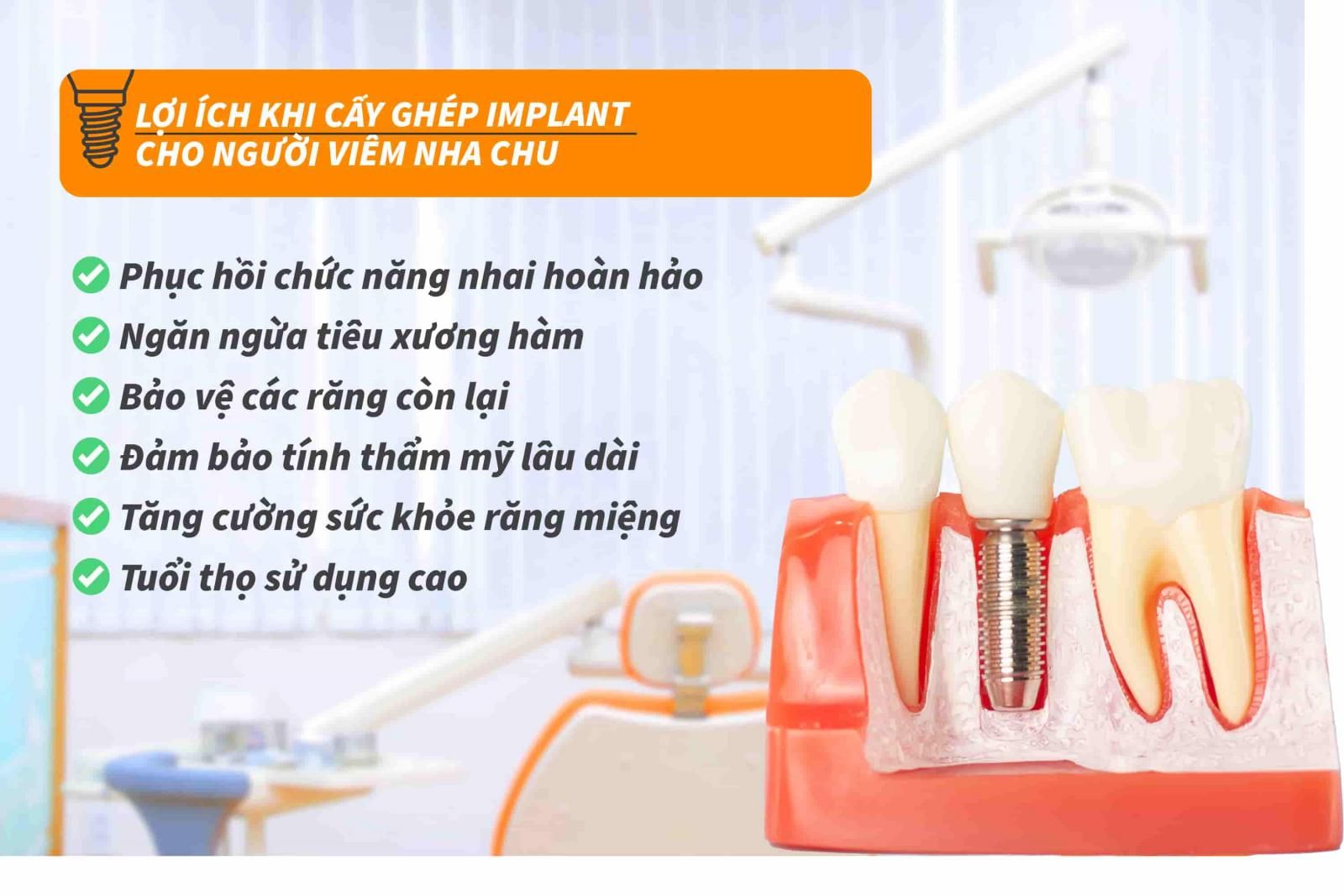 Lợi ích khi cấy ghép Implant cho người viêm nha chu