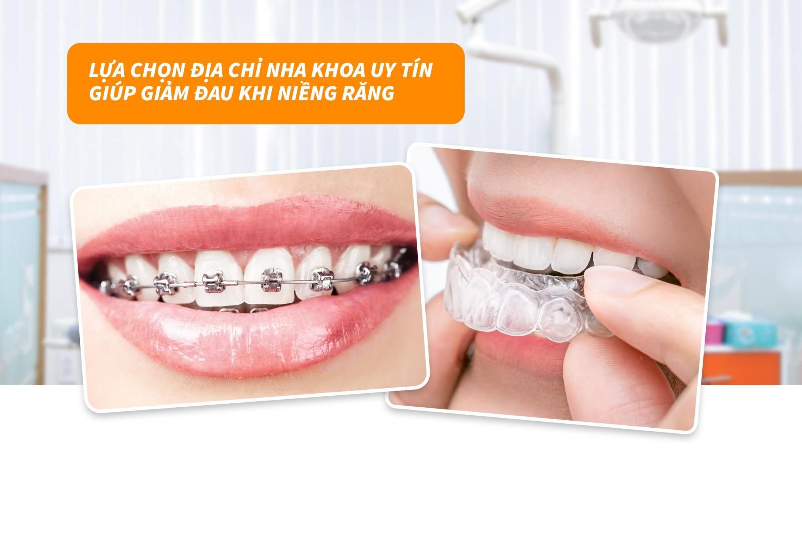 Lựa chọn địa chỉ niềng răng uy tín để giảm đau khi niềng răng