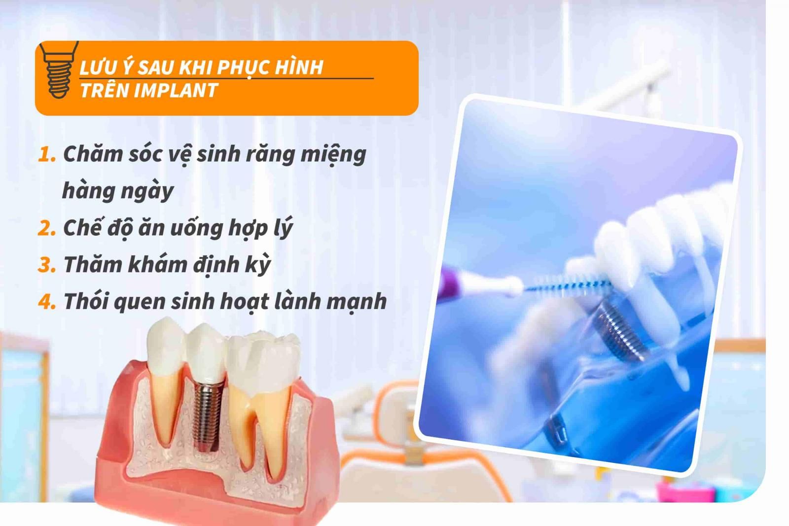 Lưu ý sau khi phục hình trên Implant