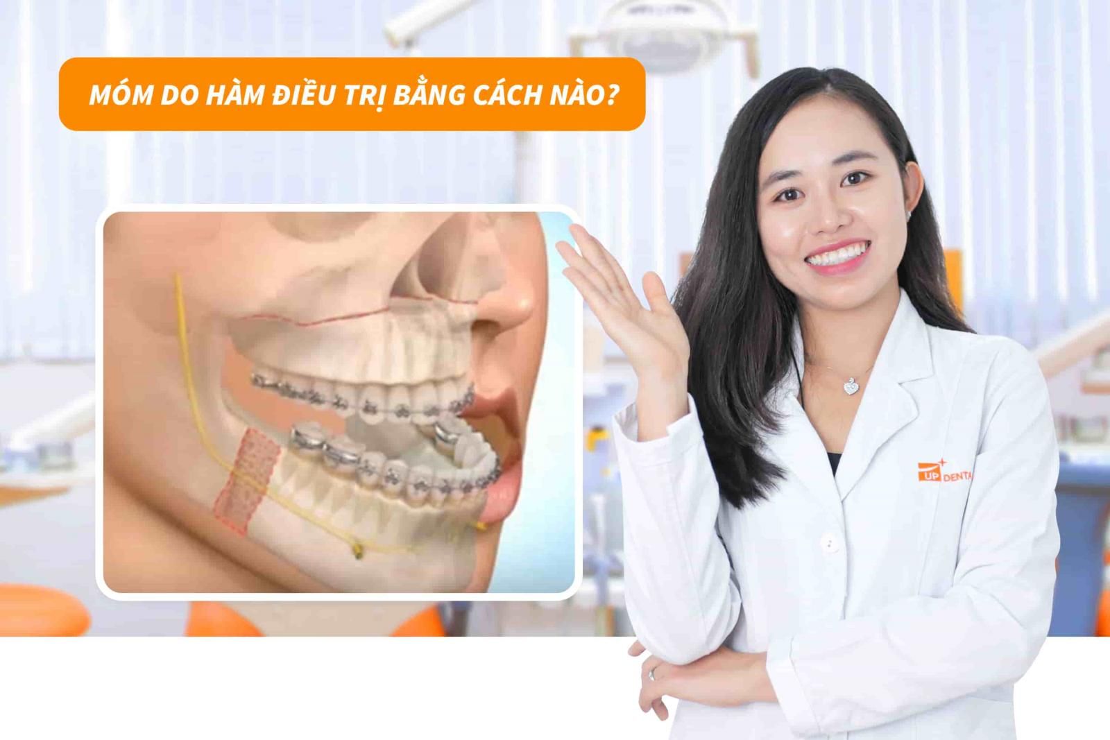 Móm do hàm điều trị bằng cách nào?