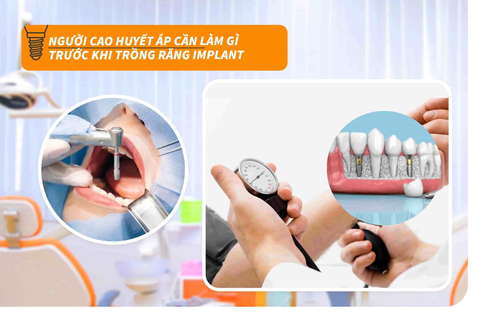 Người cao huyết áp cần làm gì trước khi trồng răng Implant