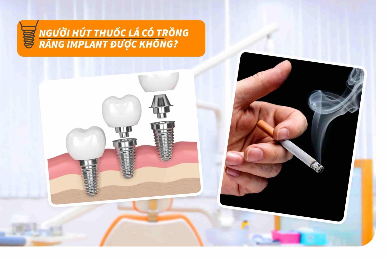 Người hút thuốc lá có trồng răng Implant được không?