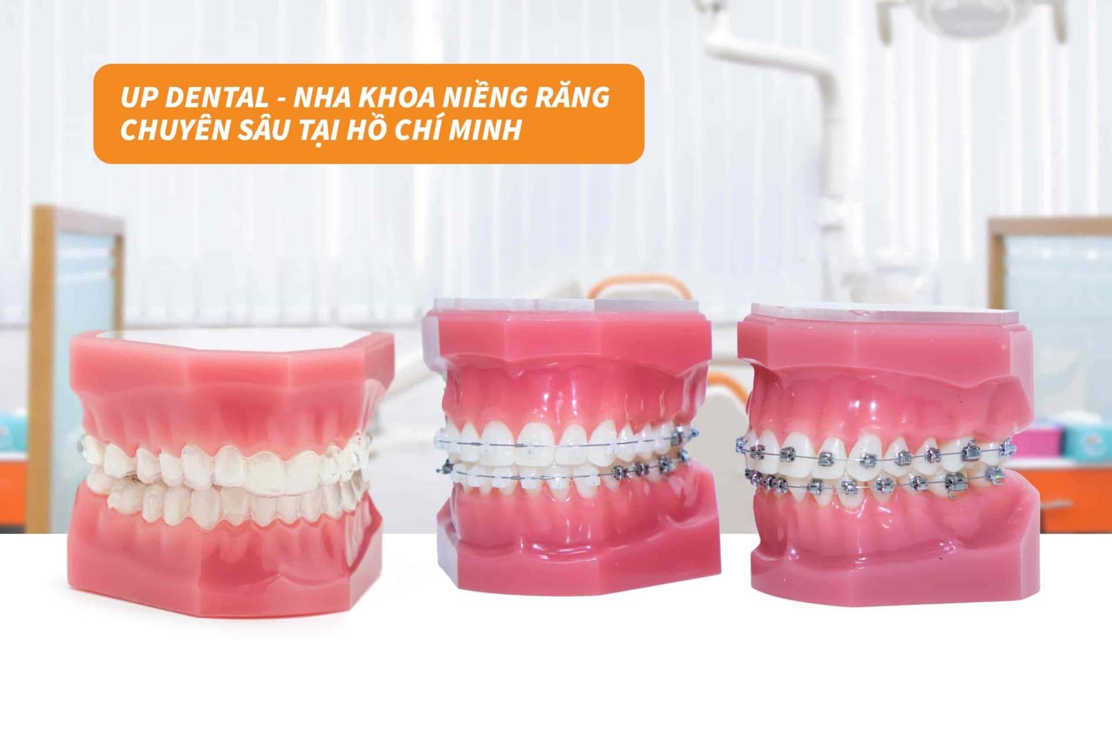 Up Dental - Nha khoa niềng răng chuyên sâu tại Hồ Chí Minh