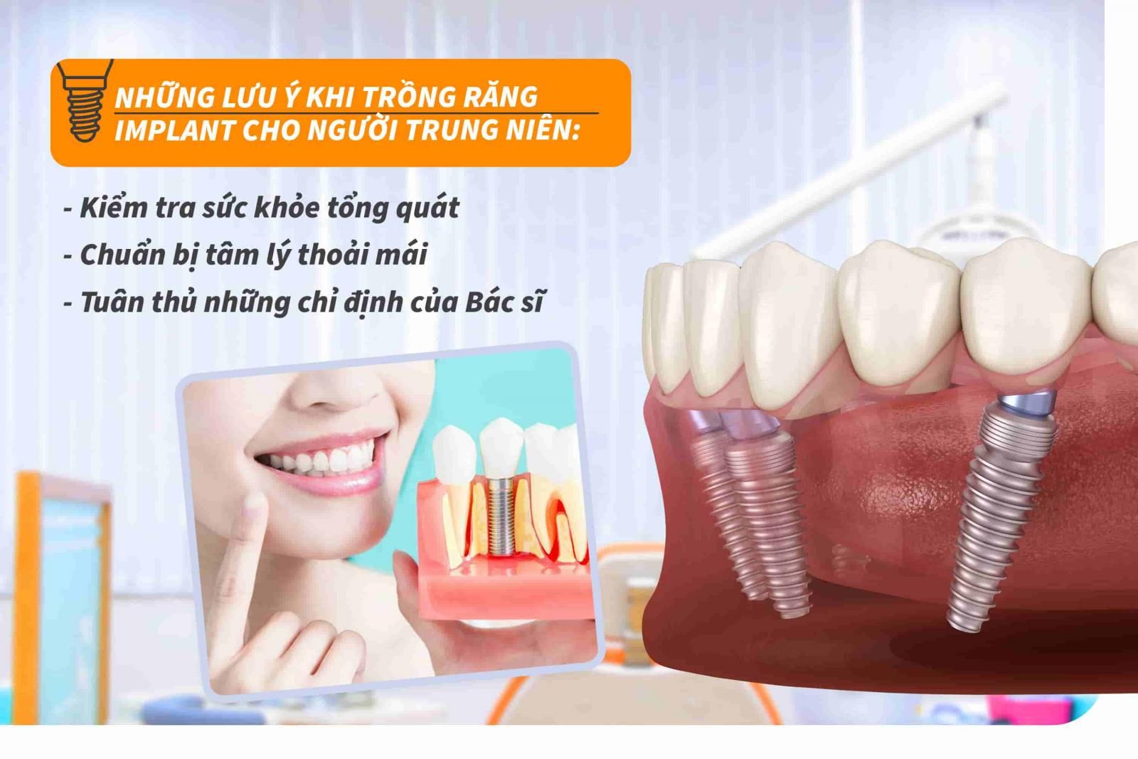 Những lưu ý khi trồng răng Implant cho người trung niên