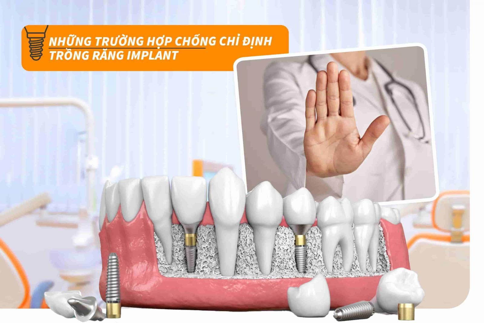 Những trường hợp chống chỉ định trồng răng Implant