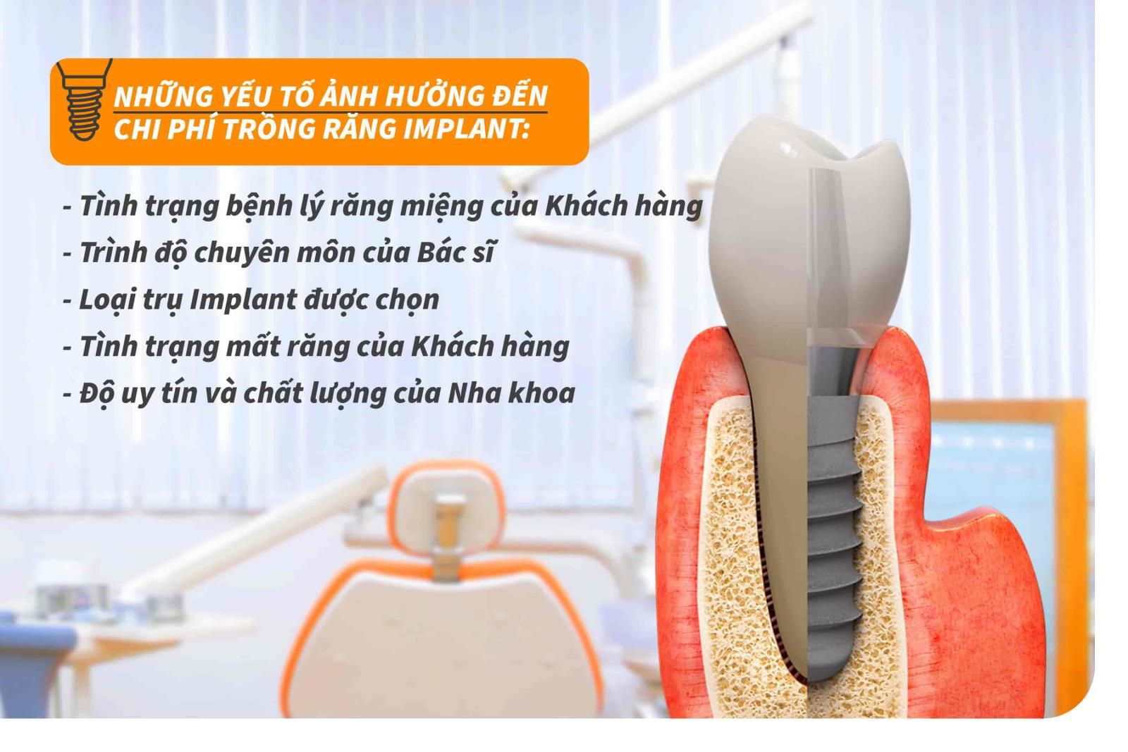 Những yếu tố ảnh hưởng đến chi phí trồng răng Implant