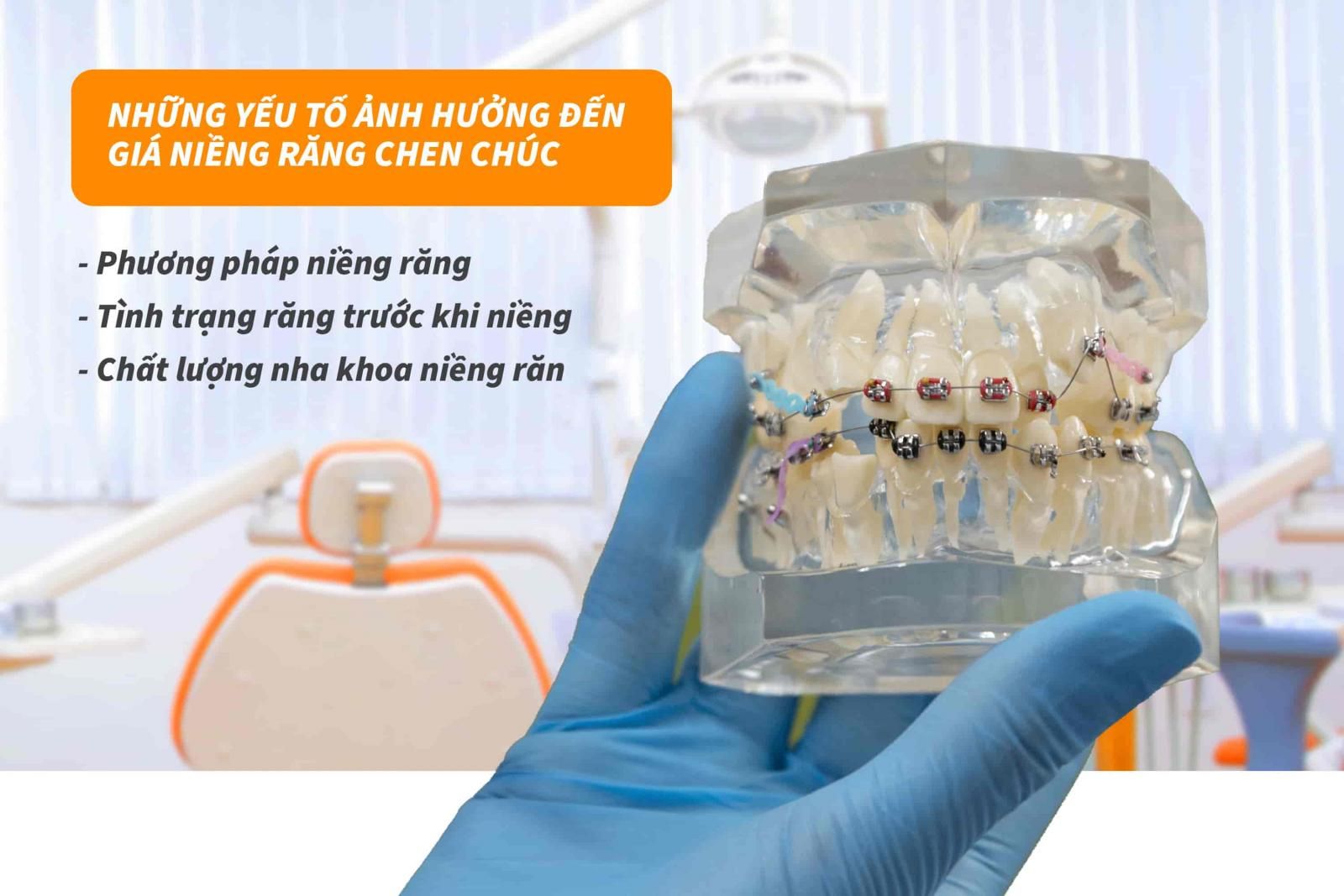 Những yếu tố ảnh hưởng đến giá niềng răng chen chúc