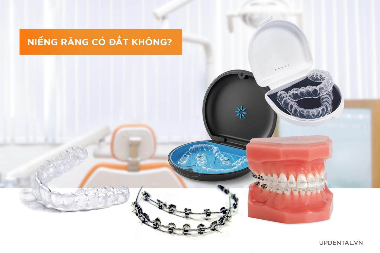 niềng răng có đắt không