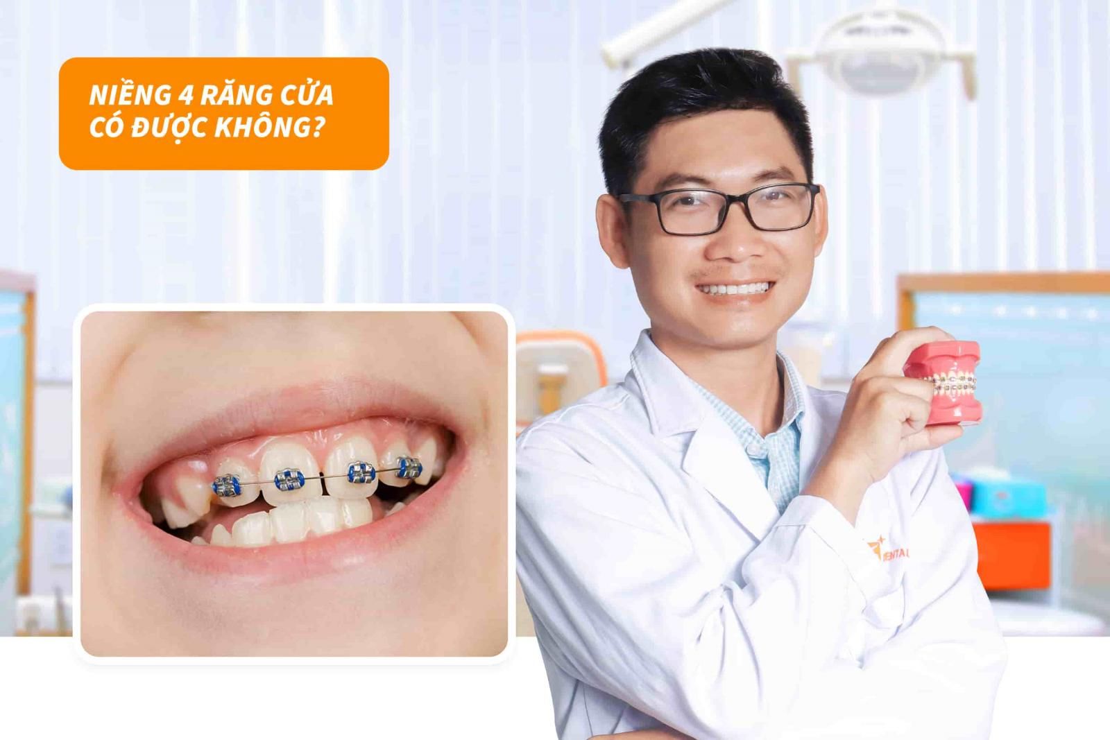 Niềng 4 Răng Cửa: Giải Pháp Hoàn Hảo Cho Nụ Cười Tự Tin