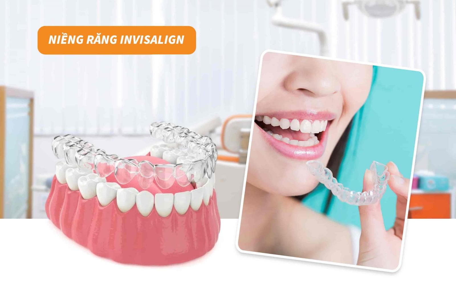 Niềng răng Invisalign