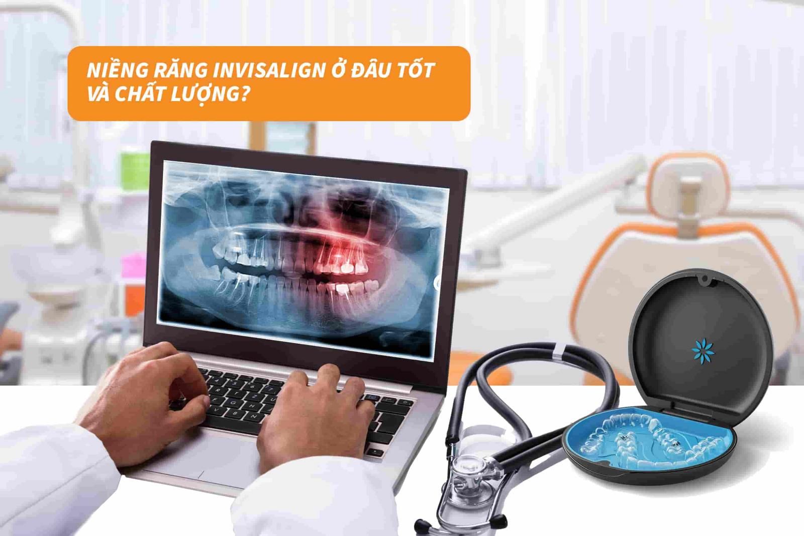 Niềng răng Invisalign ở đâu tốt và chất lượng