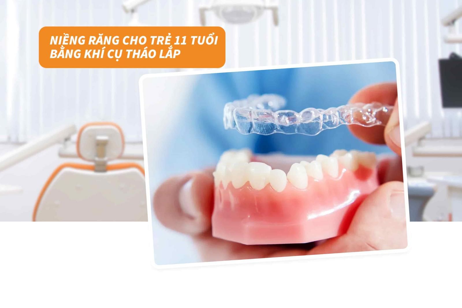 Niềng răng cho trẻ 11 tuổi bằng khí cụ tháo lắp