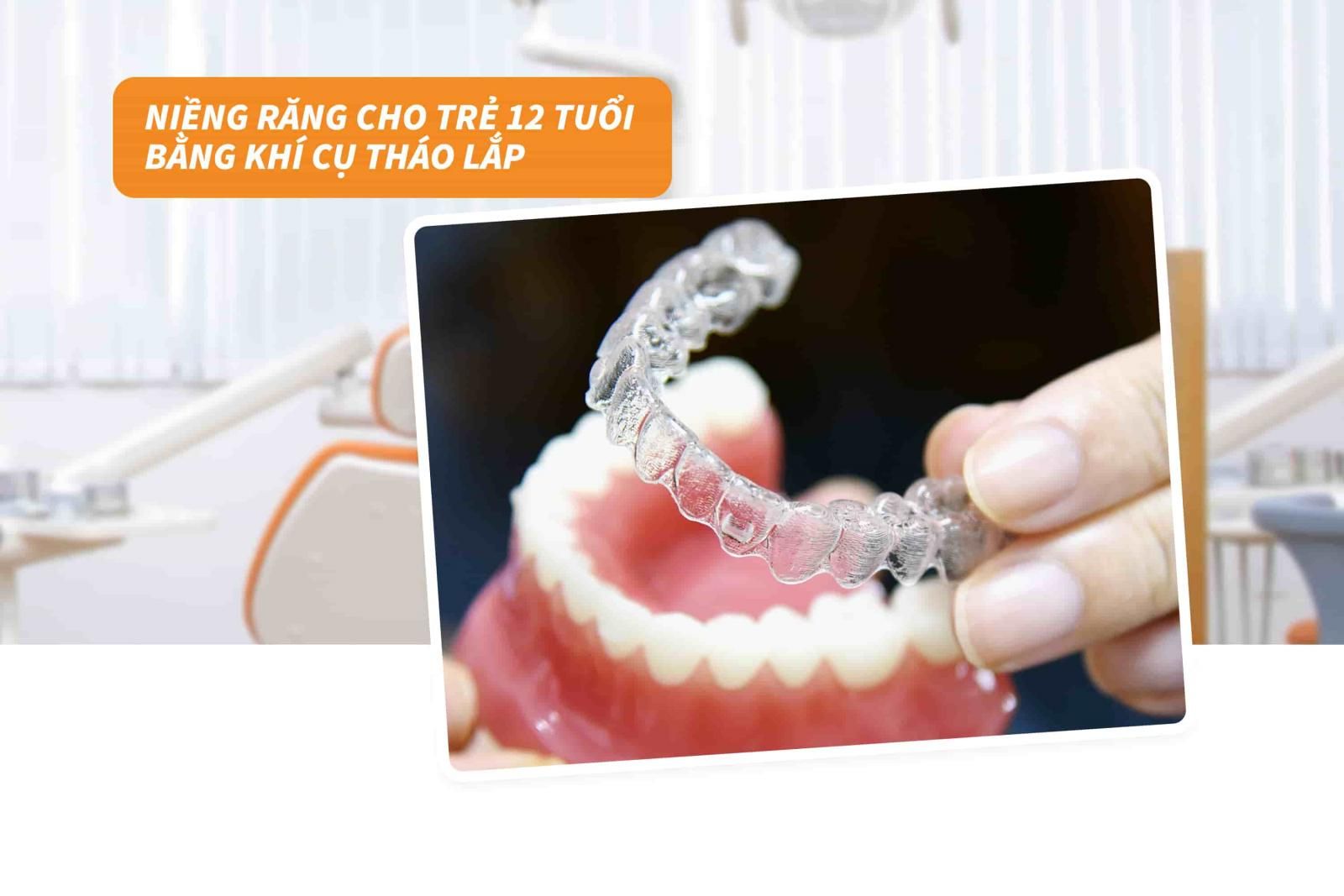 Niềng răng cho trẻ 12 tuổi bằng khí cụ tháo lắp