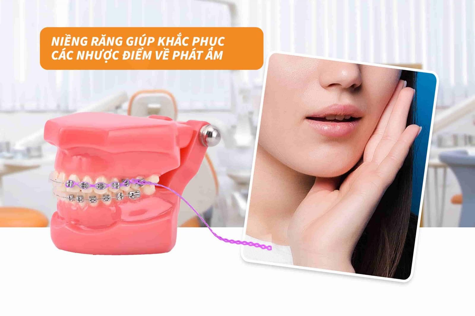 Niềng răng giúp khắc phục các nhược điểm về phát âm