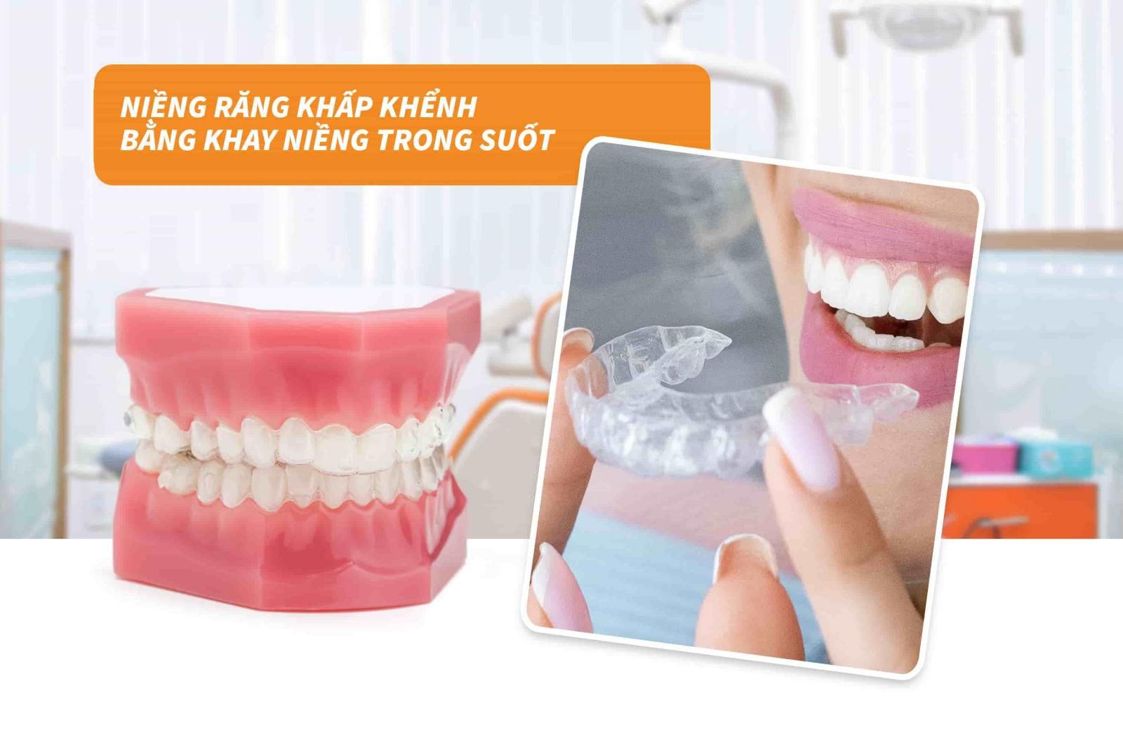 Niềng răng khấp khểnh bằng khay niềng trong suốt