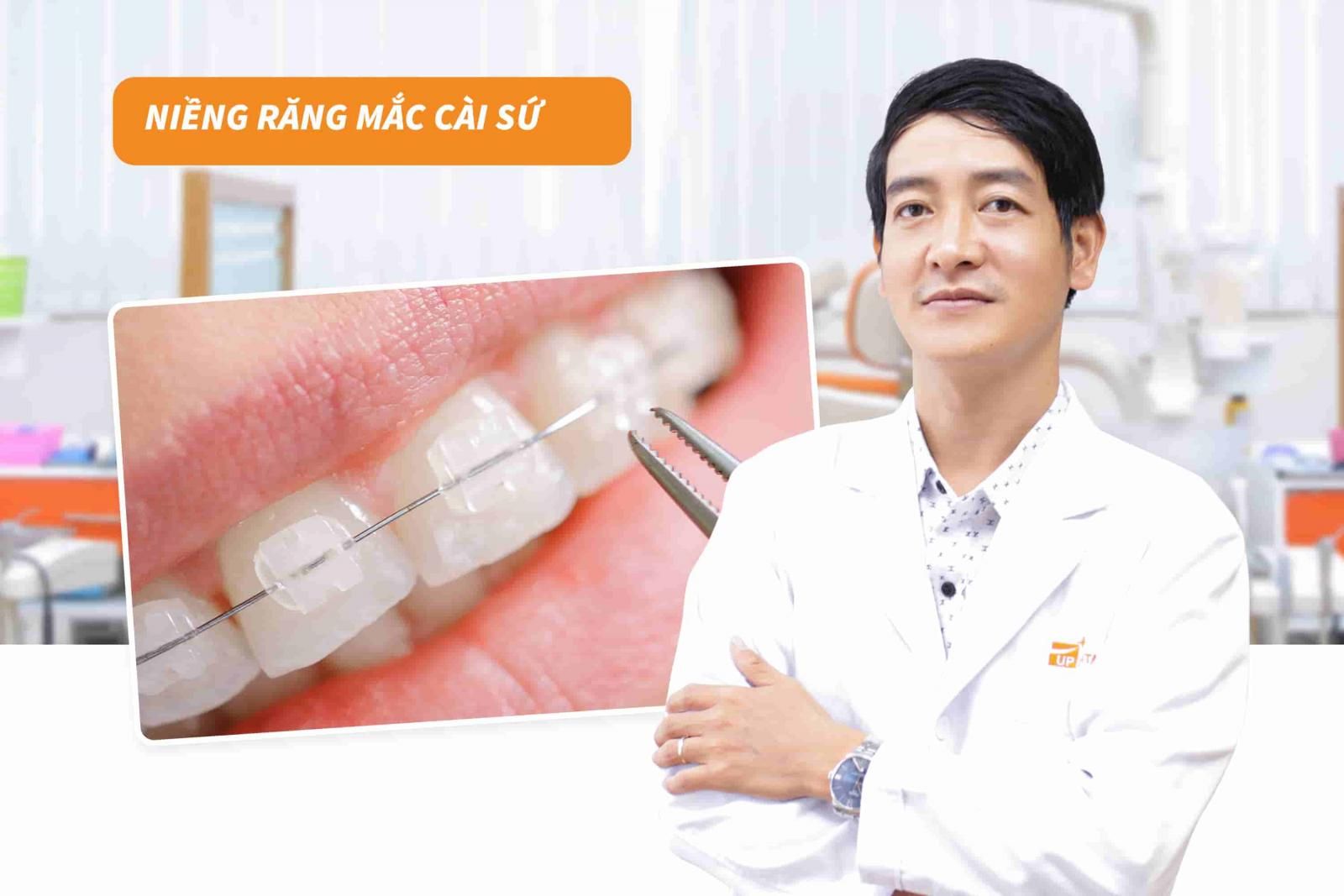 Niềng răng mắc cài sứ