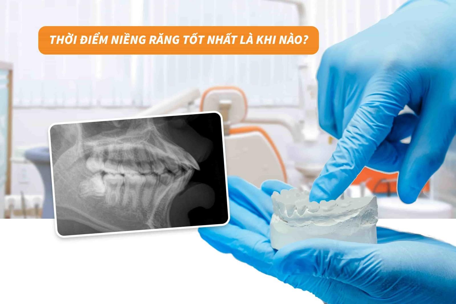 Thời điểm niềng răng tốt nhất là khi nào?