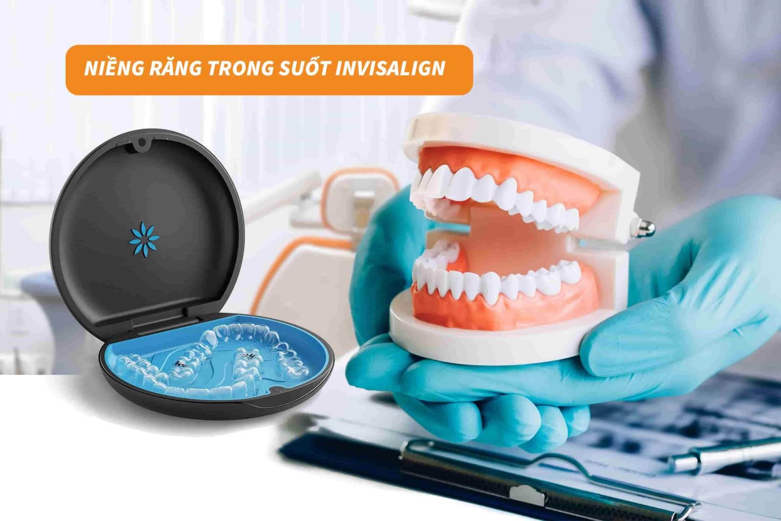 Niềng răng Invisalign