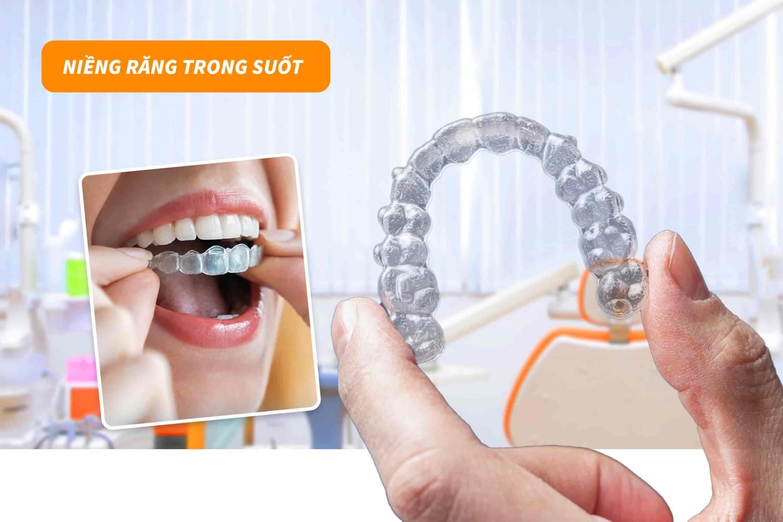 Niềng răng trong suốt Invisalign