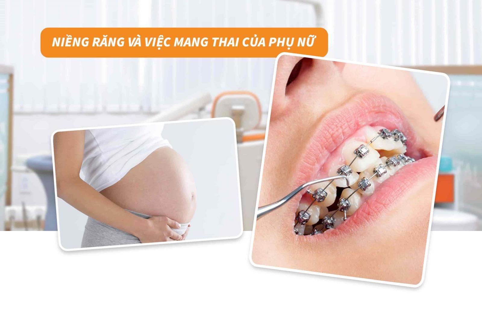 Niềng răng và việc mang thai của phụ nữ