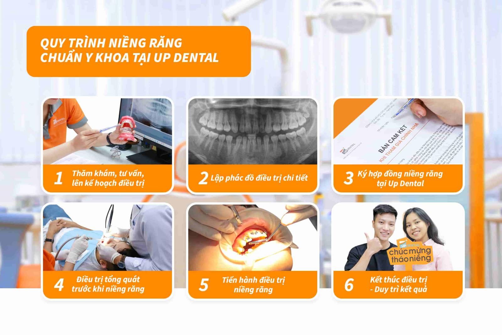 Quy trình niềng răng chuẩn Y khoa tại Up Dental