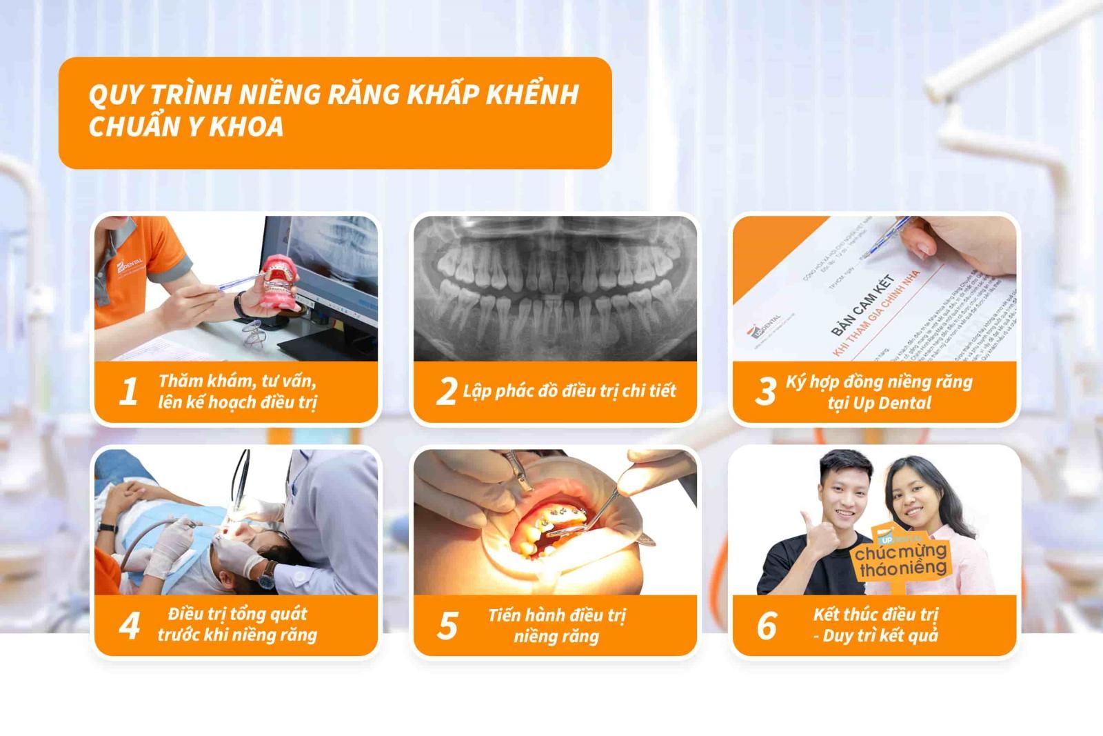 Quy trình niềng răng chuẩn Y khoa tại Up Dental