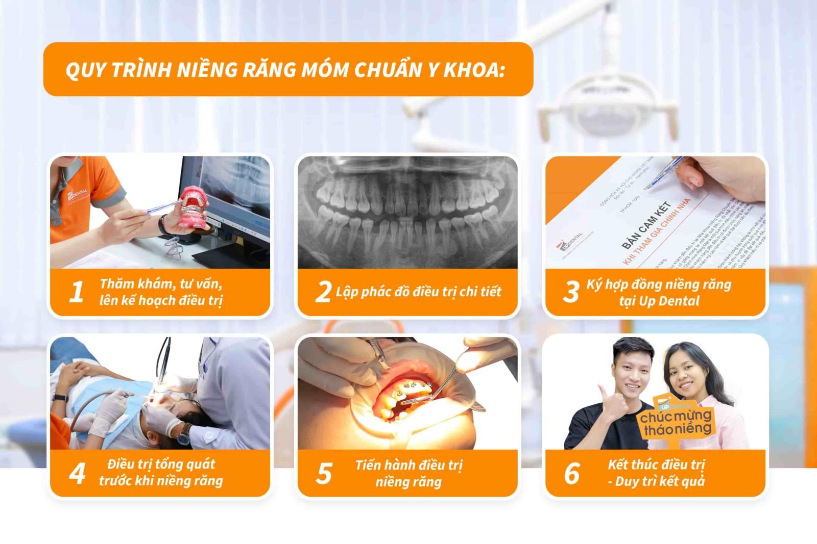 Quy trình niềng răng móm chuẩn Y khoa