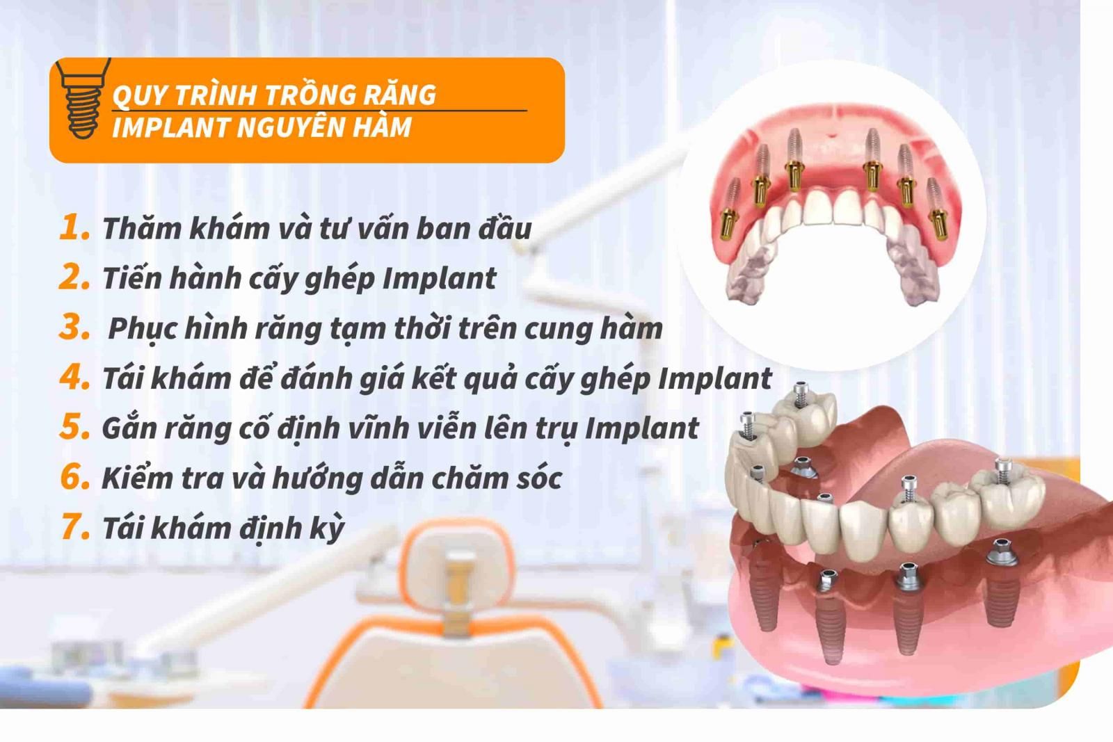 Quy trình trồng răng Implant nguyên hàm