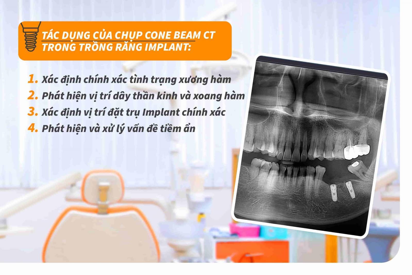 Chụp Cone Beam CT trong trồng răng Implant có tác dụng gì?