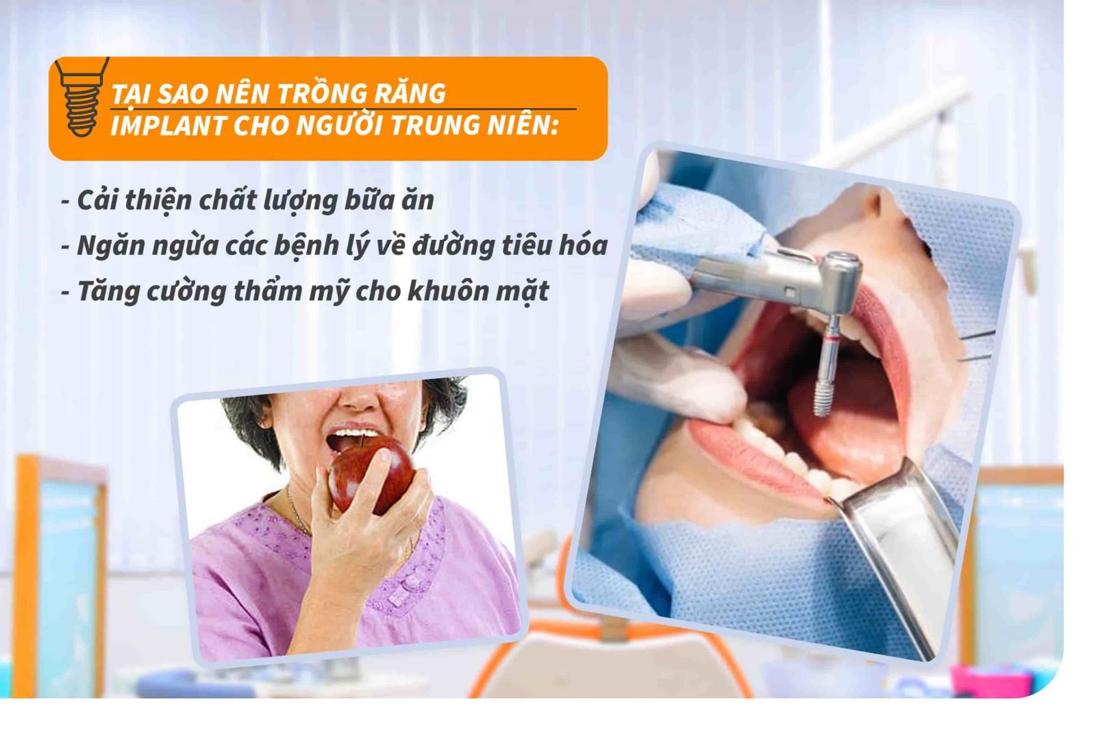 Tại sao nên trồng răng Implant cho người trung niên