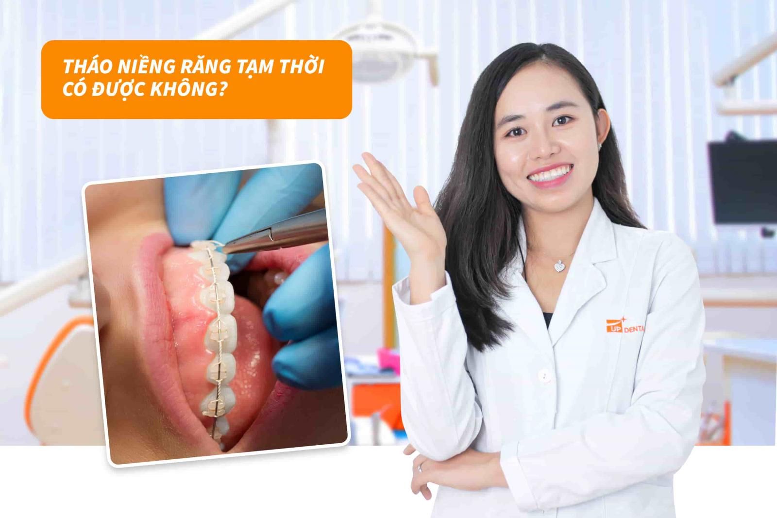 Tháo niềng răng tạm thời có được không?