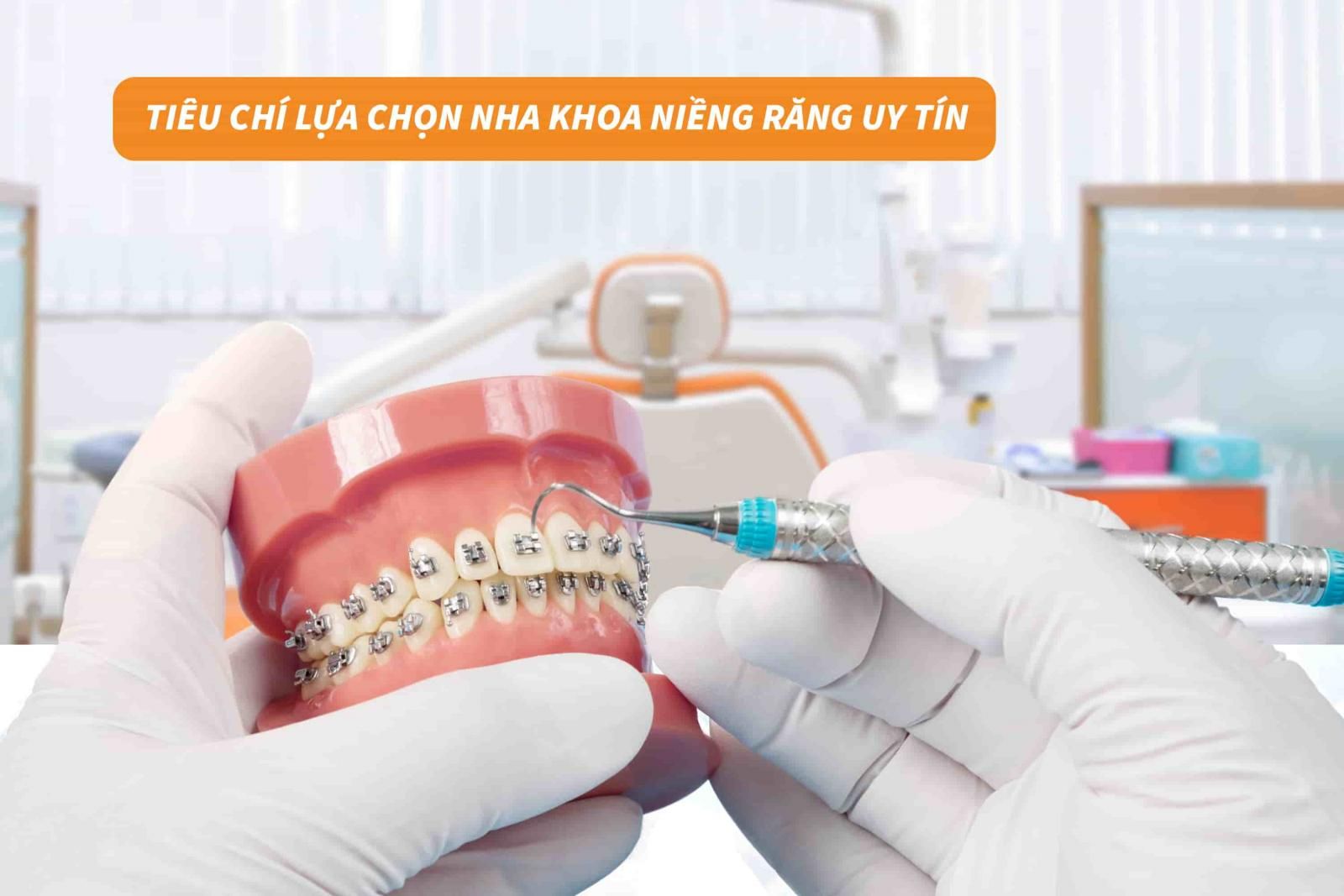 Tiêu chí lựa chọn nha khoa niềng răng uy tín