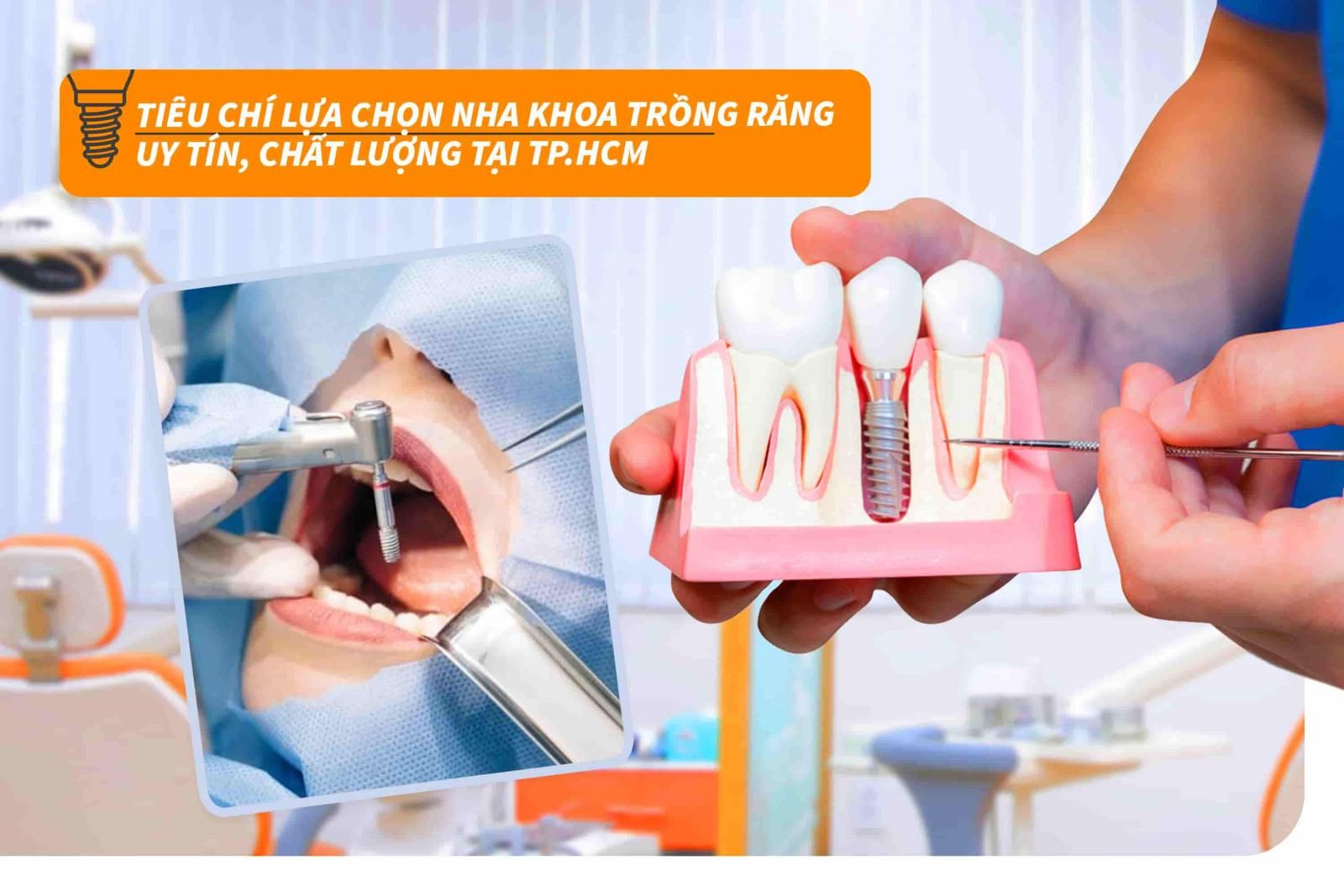 Tiêu chí lựa chọn nha khoa trồng răng uy tín, chất lượng tại TP.HCM