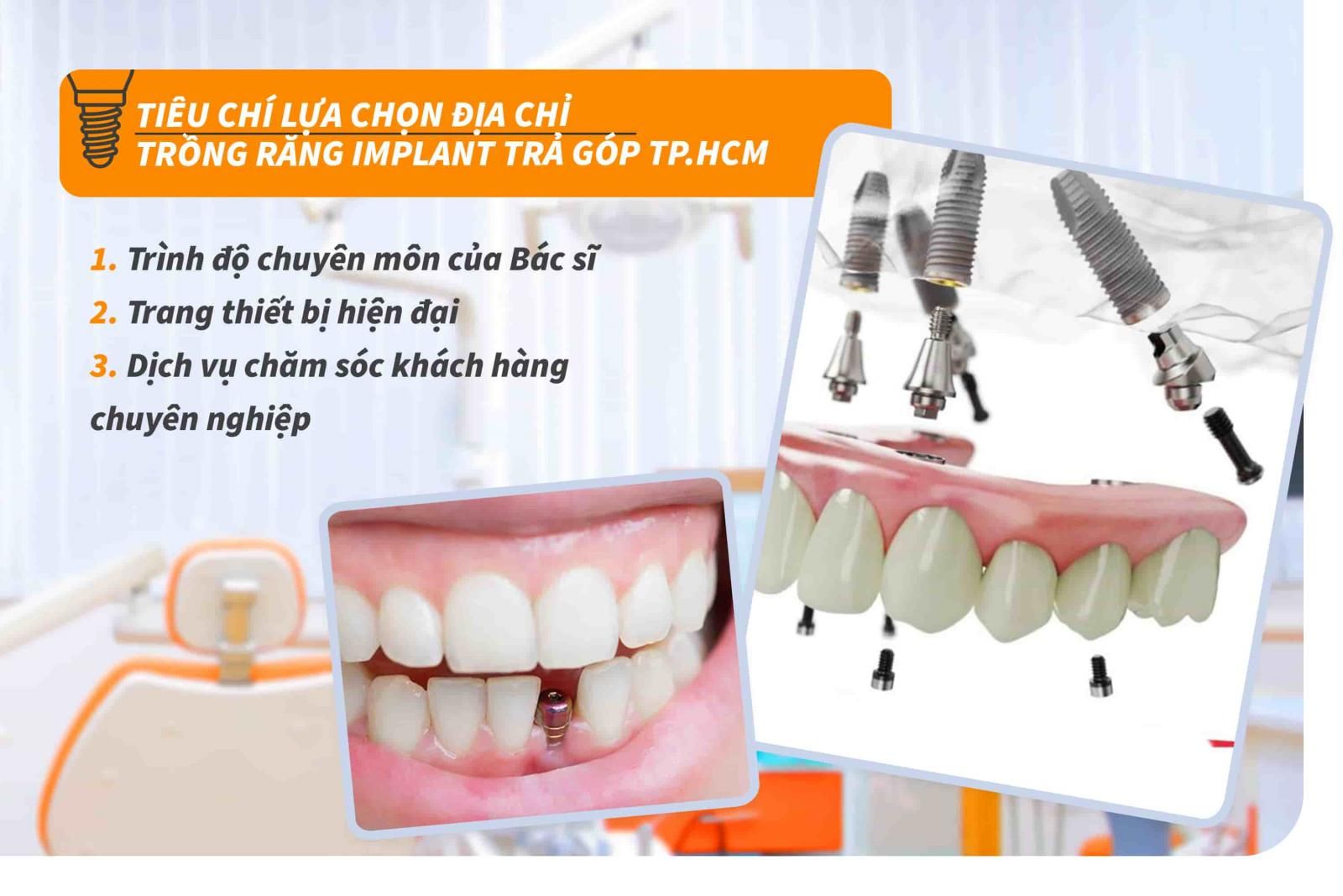 Tiêu chí lựa chọn địa chỉ trồng răng Implant trả góp TP.HCM