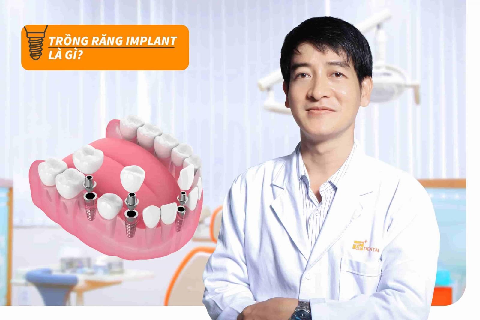 Trồng răng Implant là gì?