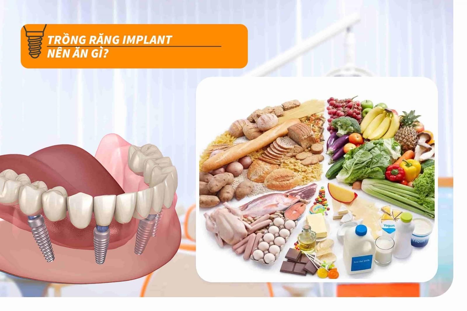 Trồng răng Implant nên ăn gì?