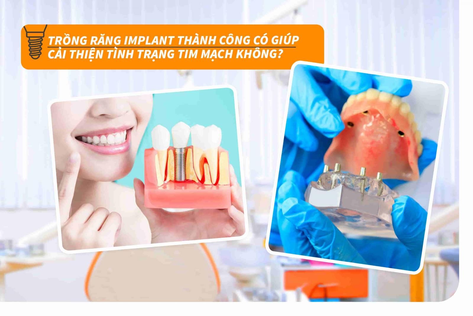 Trồng răng Implant thành công có giúp cải thiện tình trạng tim mạch không?