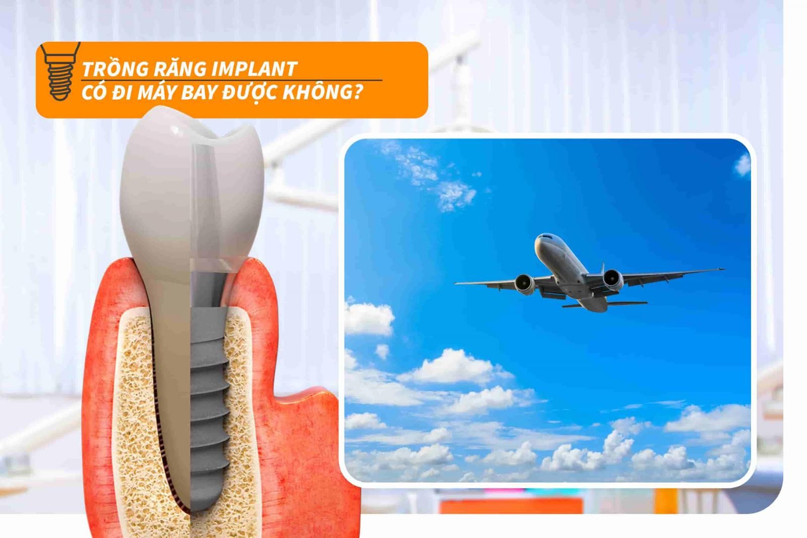 Trồng răng Implant có đi máy bay được không?