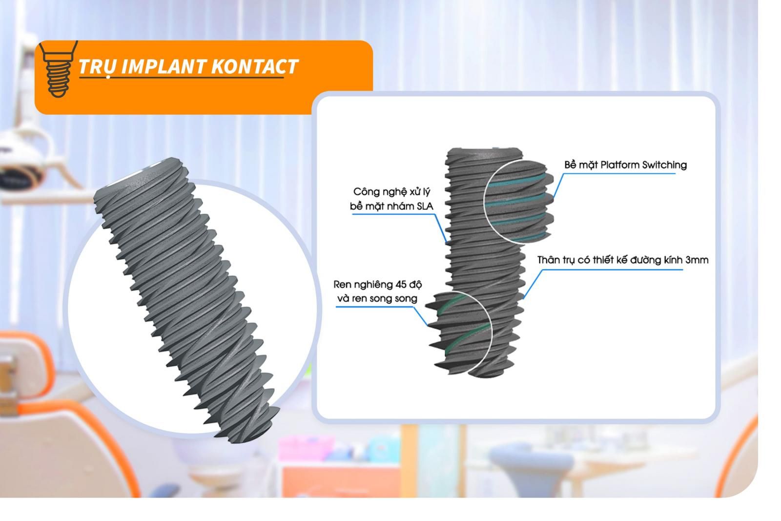 Trụ Implant Kontact Pháp