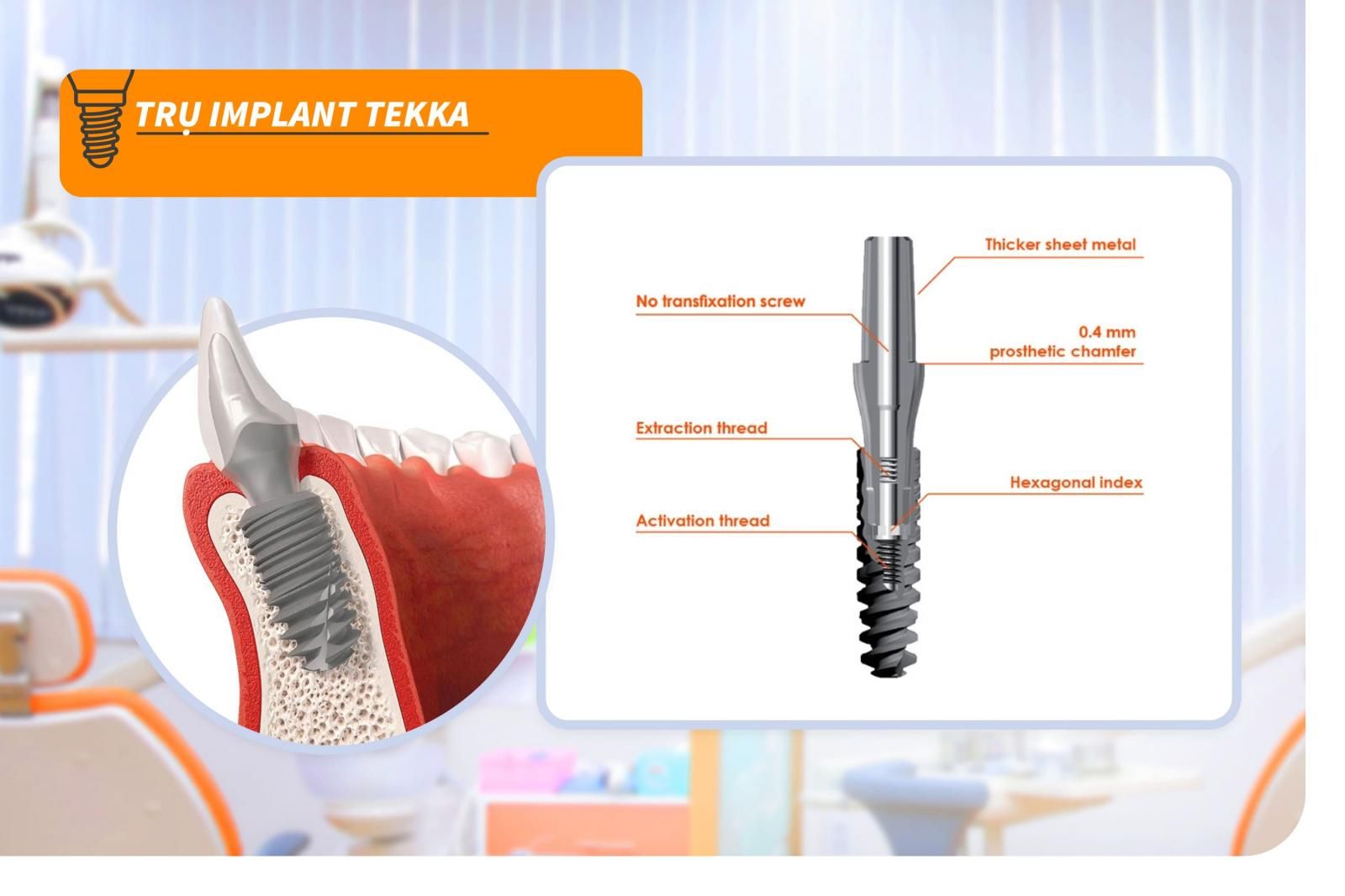 Trụ Implant Tekka Pháp