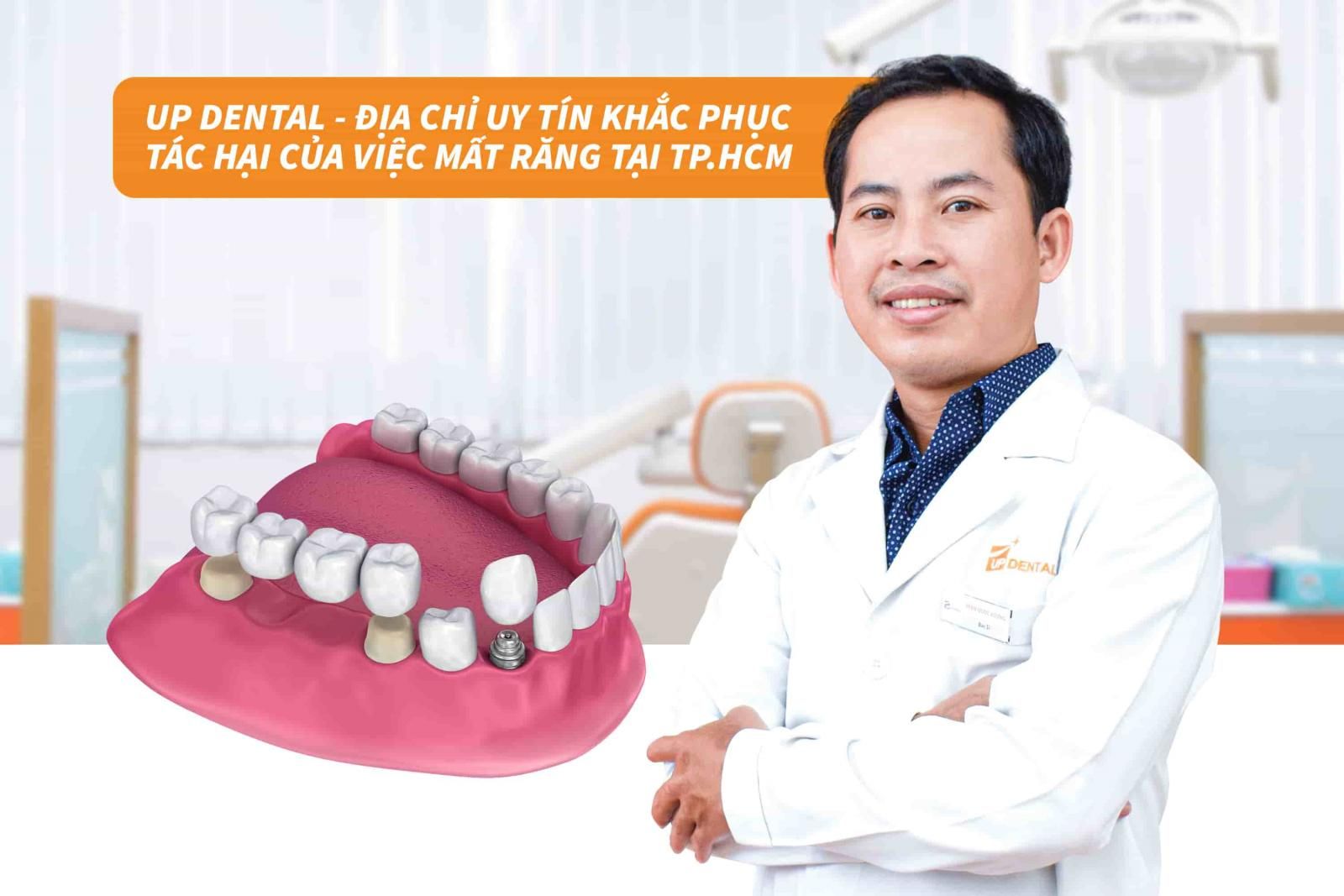 Up Dental - Địa chỉ uy tín khắc phục tác hại của việc mất răng