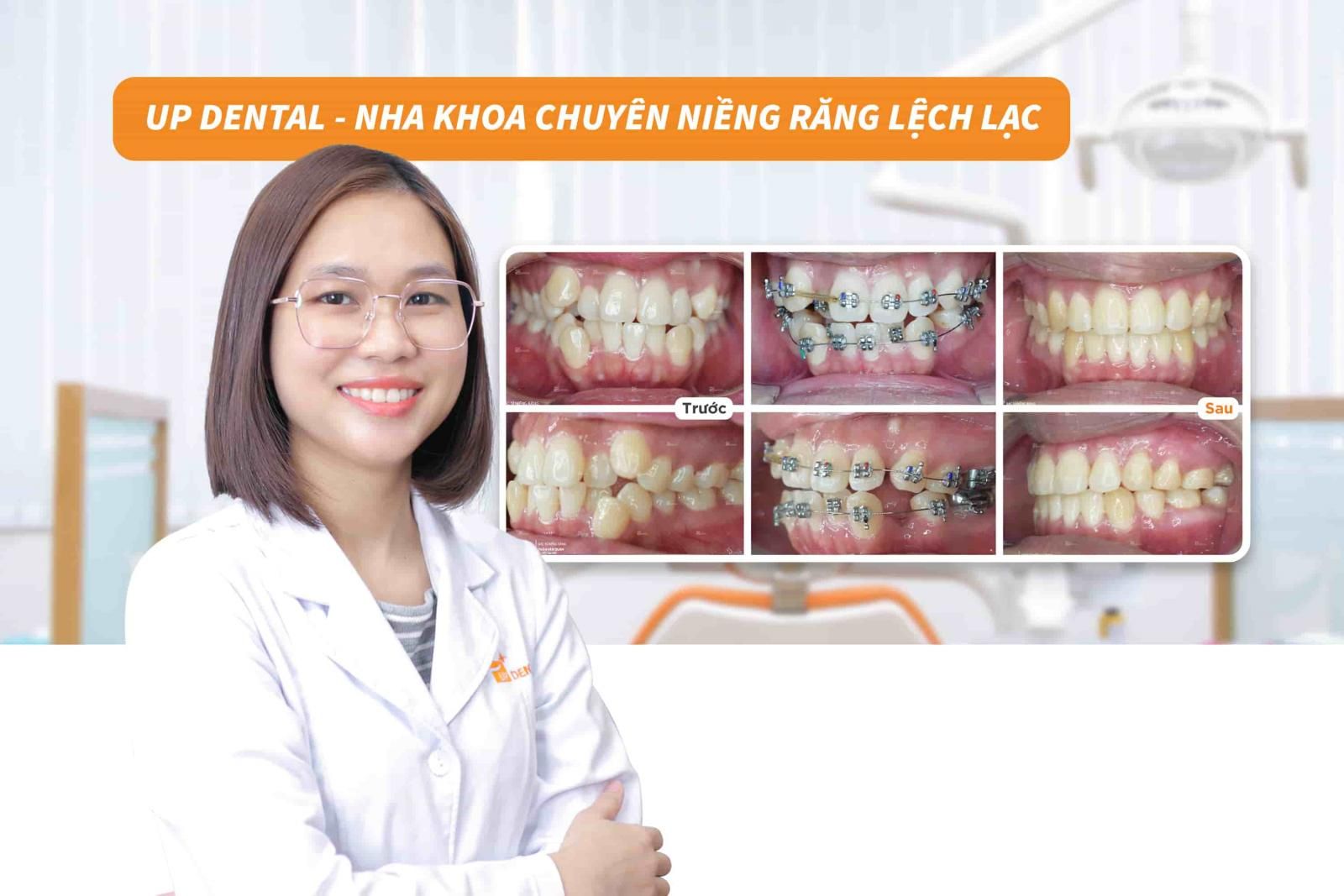 Up Dental - Nha khoa chuyên niềng răng lệch lạc