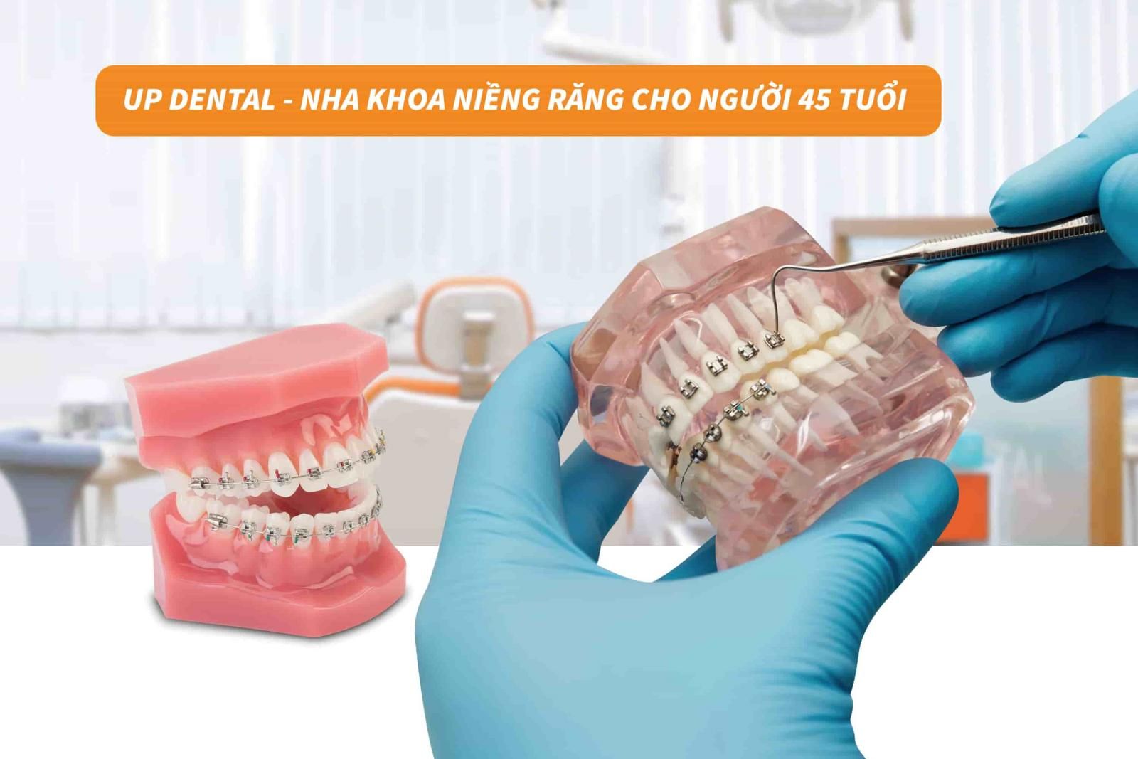 Up Dental - Nha khoa niềng răng cho người 45 tuổi